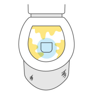 便器の汚れが落ちにくい